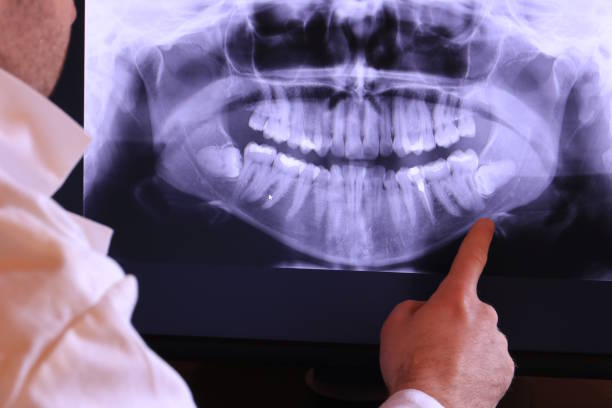 Best Dentist for Tooth Abscess  in Smiths Station, AL